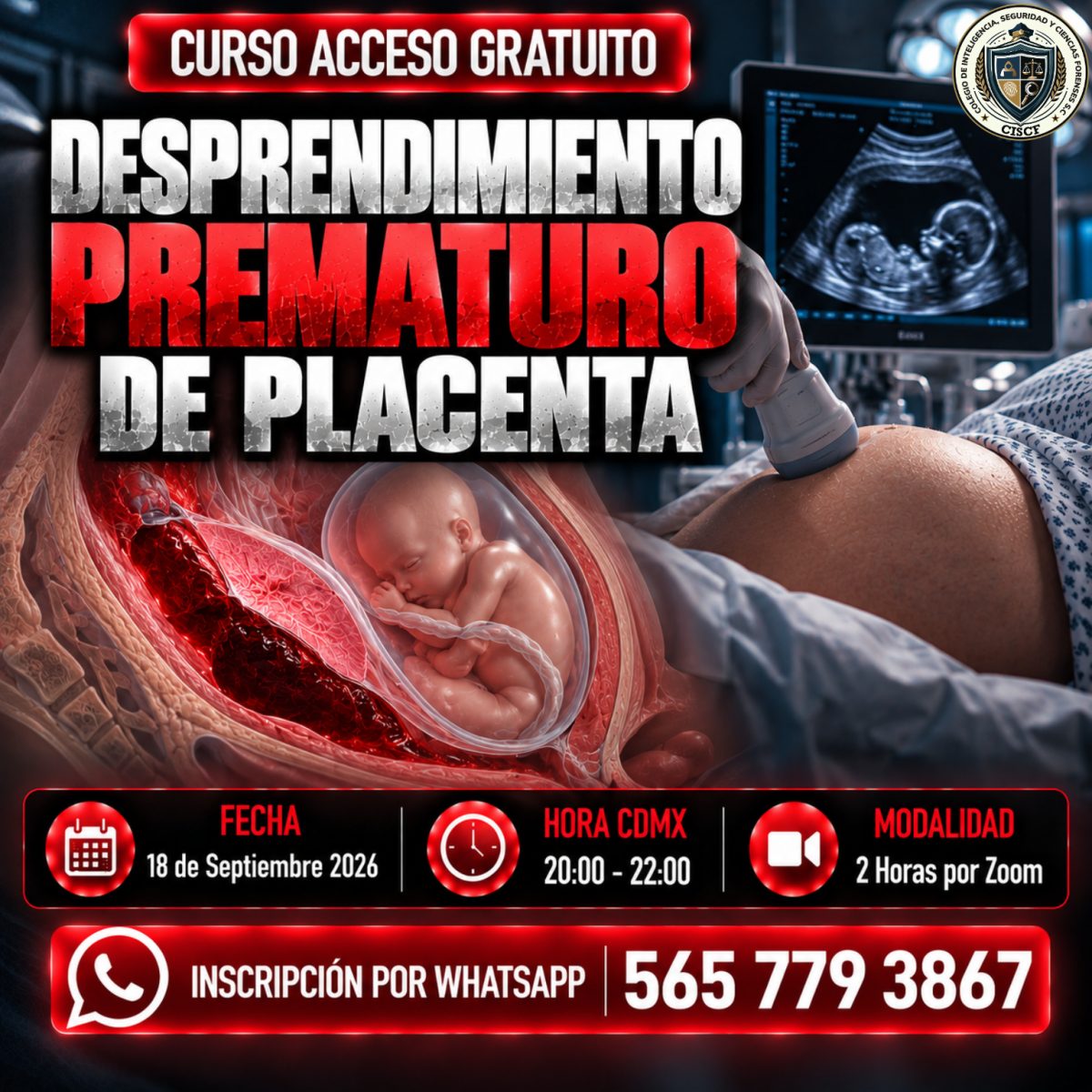 Desprendimiento Prematuro de Placenta