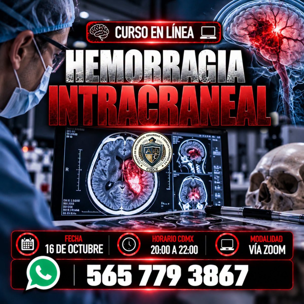 Hemorragia Intracraneal