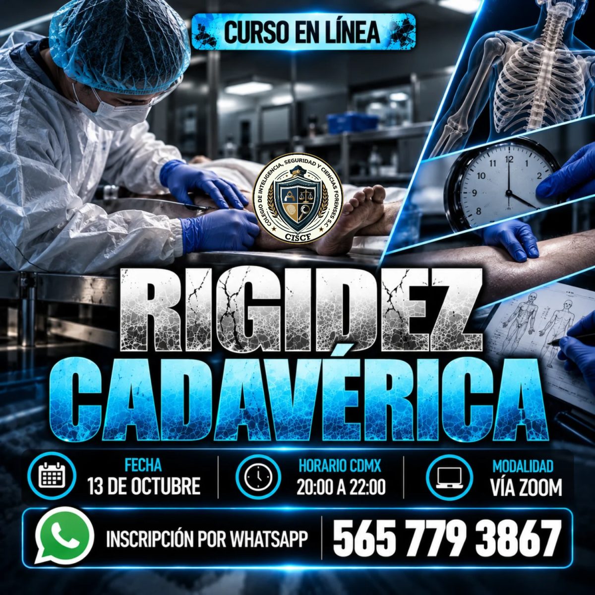 Rigidez Cadavérica